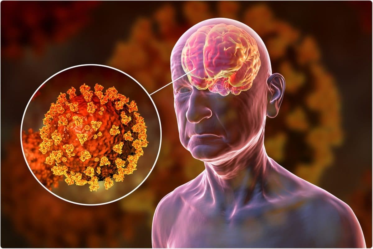 Quels sont les dégâts que le covid-19 a sur le cerveau humain ? Trouble de la vigilance ou encore maux de tête, certains symptômes neurologiques sont liés à la maladie de la Covid-19. La Covid-19 a engendré plusieurs dégâts qui continuent de déstabiliser le monde jour après jour. Une recherche menée par plusieurs chercheurs affirme que le SARS-CoV-2 provoquerait d’effets négatifs sur le cerveau. Les dommages de Covid-19 au cerveau humain Le Covid-19 est une maladie qui touche de nombreux organes humains. Bien que les problèmes respiratoires soient les problèmes les plus symboliques ou emblématiques et les plus étudiés, le cerveau également ne se voit pas épargné. La Radiological Society of North America (RSNA) a entrepris de déterminer l’incidence des lésions cérébrales chez les patients atteints d’une infection confirmée par le SRAS-CoV-2. « Nos recherches prouvent que dans cette pandémie dévastatrice, les dégâts dans le cerveau sont une cause importante de morbidité et de mortalité », a souligné Thomas Jefferson, premier responsable du département de radiologie et de neurologie de l’Université de Philadelphie. En effet, sur les 39 750 personnes qui ont été traitées dans 11 centres médicaux (aux États-Unis et en Europe) ayant pris part à l’étude, 4 342 parmi eux ont subi des scintigraphies cérébrales médicales. À la fin de ces examens, les images ont présenté plusieurs anomalies visibles pour 10 % d’entre eux. Que sait-on des symptômes neurologiques du Covid-19 ? Les lésions nerveuses associées au Covid-19 sont diverses, allant de symptômes légers et transitoires tels que la perte du goût et de l’odorat à des affections plus sévères telles que des encéphalopathies, l’épilepsie et les accidents vasculaires cérébraux. Une recherche publiée dans le Journal of Radiology le 1er avril 2020 a souligné le cas d’une femme américaine de 60 ans qui a développé une encéphalopathie hémorragique nécrosante sévère après avoir été testée positive au Covid-19. Il s’agit d’une maladie neurologique moins courante qui se caractérise par différents niveaux de dysfonctionnement rénal, une altération de l’état de conscience, un déclin neurologique et des convulsions. Le Dr Alessandro Padovani, qui a créé un service NeuroCovid à l’hôpital universitaire de Brescia en Italie pour traiter les patients atteints de maladies neurologiques, a souligné que les médecins ont également signalé que certains patients avaient eu des pertes de repères et des délires bien avant de manifester une fièvre ou une maladie respiratoire. Qu’en est-il du cerveau en développement ? Au cours de la même conférence, le RSNA s’est également intéressé à l’impact du Covid-19 sur le cerveau des nourrissons. Une infection négligeable à modérée au cours de la grossesse, pour les femmes étudiées à environ 28 semaines, ne semble pas avoir d’effets sur le cerveau du futur bébé. « Dans la recherche que nous avons menée, il n’y a aucune preuve qui confirme que l’infection maternelle par le SRAS-CoV-2 pourrait avoir un quelconque impact sur le développement du cerveau du futur bébé », a déclaré la Dr Sophia Stocklin, membre de la recherche. Par ailleurs, les cas confirmés de transmission verticale du SRAS-CoV-2 de la mère à l’enfant sont moins fréquents, et son impact sur la santé du futur bébé reste à déterminer.